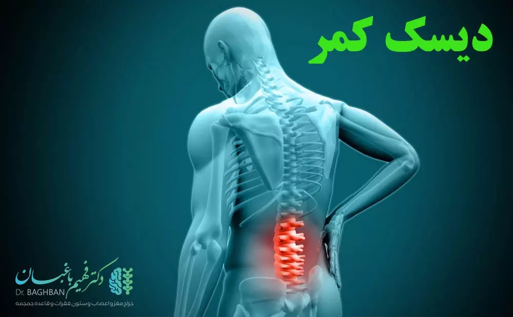 درخواست وکیل برای دریافت دیه دیسک کمر