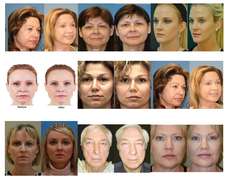 قرص اپل فت فست 60 تایی APPLE دو ایکس مشکی اصلی