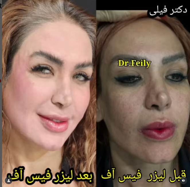 دکتر امیر فیلی