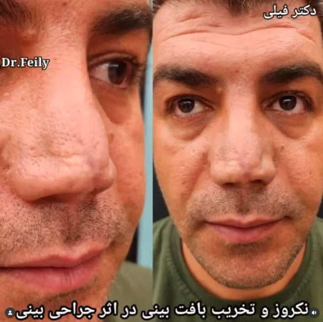 دکتر امیر فیلی