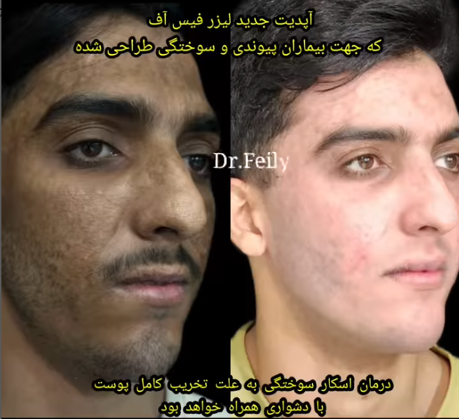 بهترین دکتر پوست 