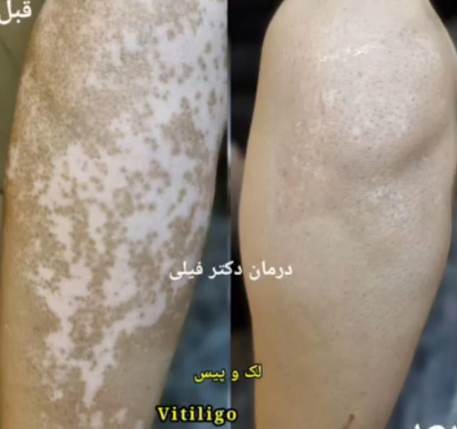 بهترین دکتر پوست