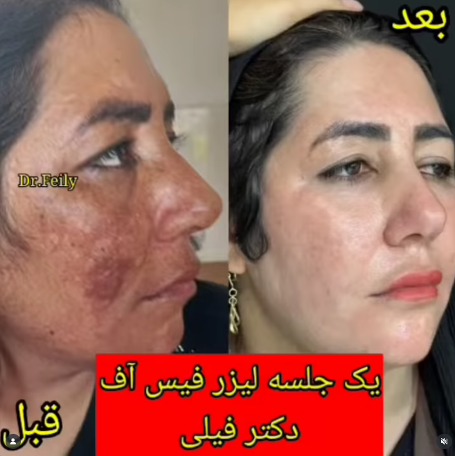 بهترین دکتر پوست