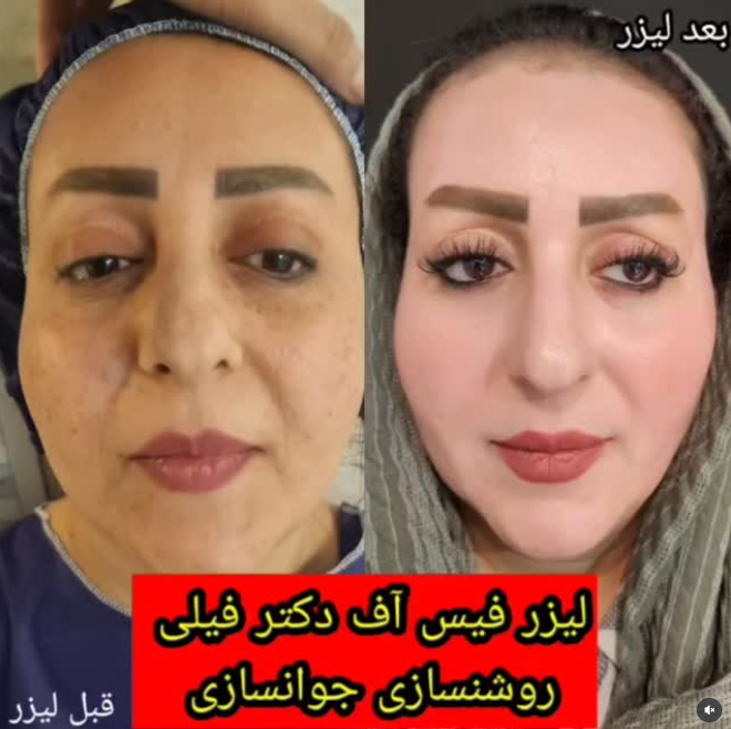 بهترین دکتر پوست